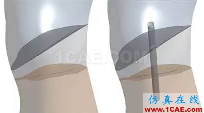 亞當(dāng)沉浮錄--大都會(huì)藝術(shù)博物館的保管員邀請(qǐng)仿真專家?guī)椭迯?fù)具有600年歷史的雕塑 美國仿真專家首次利用ANSYS協(xié)助修復(fù)破損的雕塑ansys培訓(xùn)課程圖片6