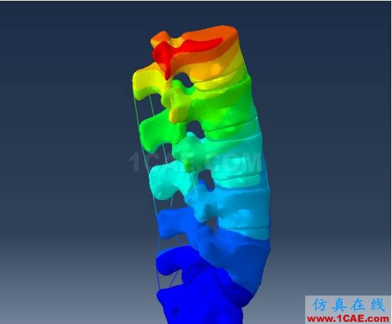 【醫(yī)學應(yīng)用】骨科知識和有限元分析ansys圖片3