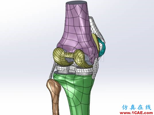 【醫(yī)學應(yīng)用】骨科知識和有限元分析ansys圖片4