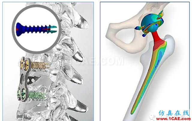 生命中的一天｜CAE仿真無(wú)處不在【轉(zhuǎn)發(fā)】ansys圖片22